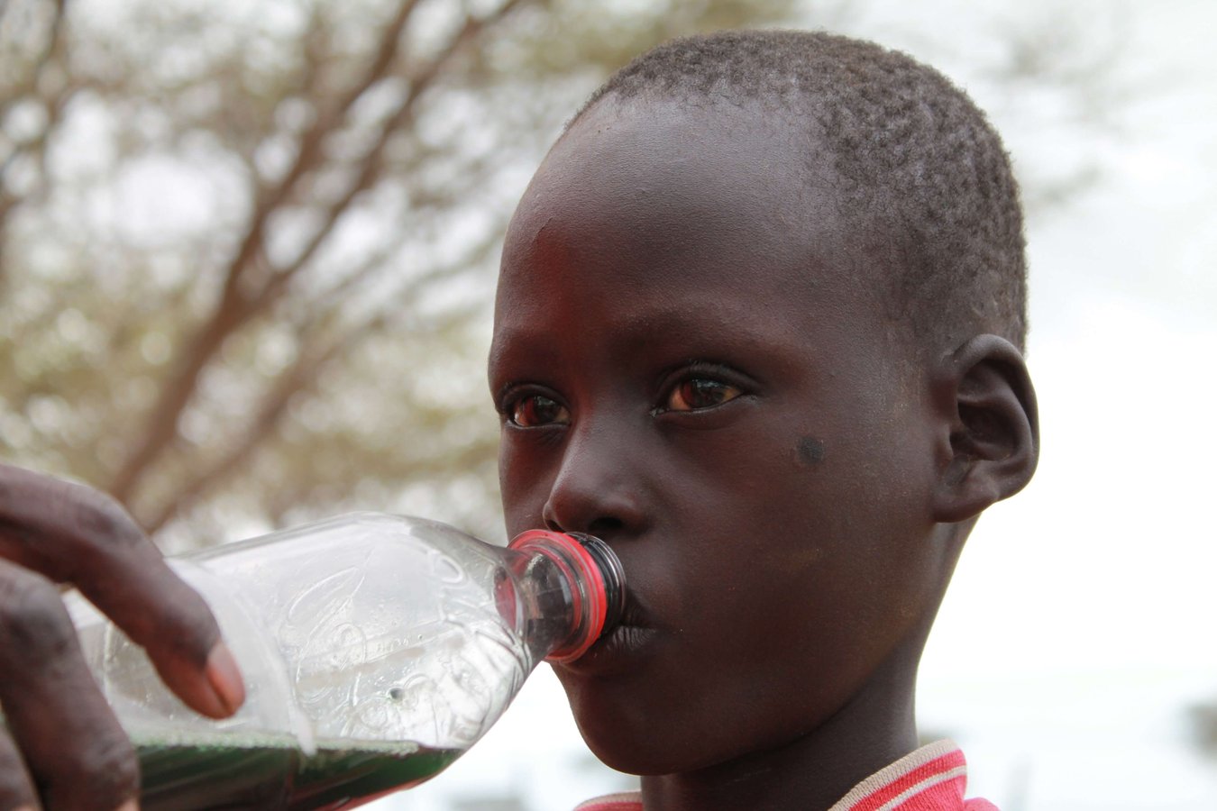 Ein mangelernährtes Kind trinkt Spirulinasaft